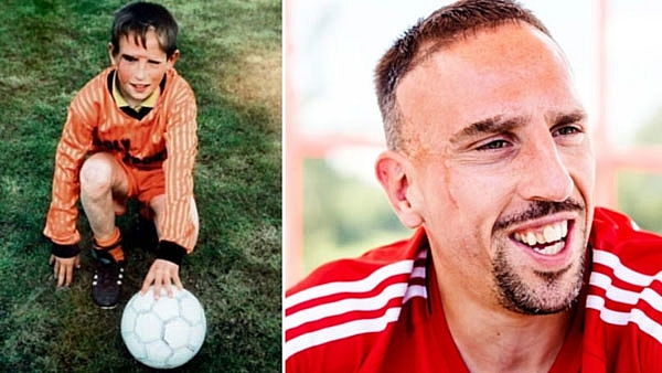 Ribery mang mặt sẹo từ 2 tuổi, không biết mặt bố mẹ đẻ