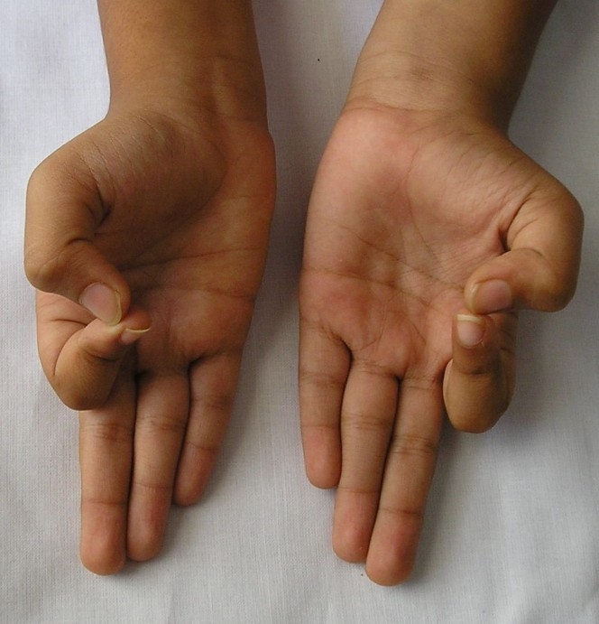 8 động tác ngón tay đơn giản giúp xua tan bệnh tật