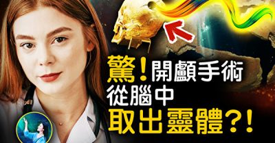 Phẫu thuật cắt hộp sọ đã có từ thời cổ đại?