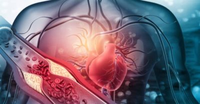 4 dấu hiệu máu đặc, 7 cách thông mạch, ngăn ngừa nhồi máu cơ tim