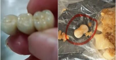 Đáng sợ! Lạp xưởng Cát Lâm ăn phải 3 chiếc răng, xíu mại Quảng Đông ăn phải 2 chiếc